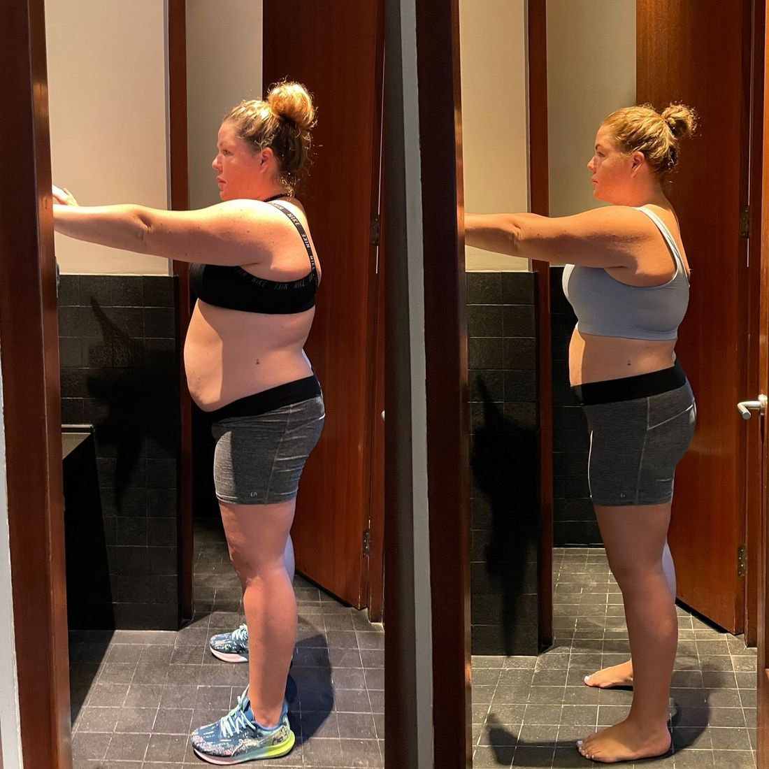 Side-view before and after showing a much smaller waist and stomach